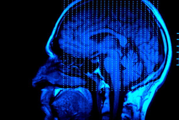 El cerebro de Caín